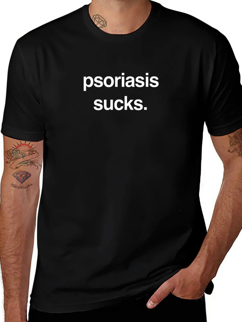 Sucks - Skin Psoriasis Awareness Gift Breathable Soft Cotton T-Shirt – Timeless Casual Look