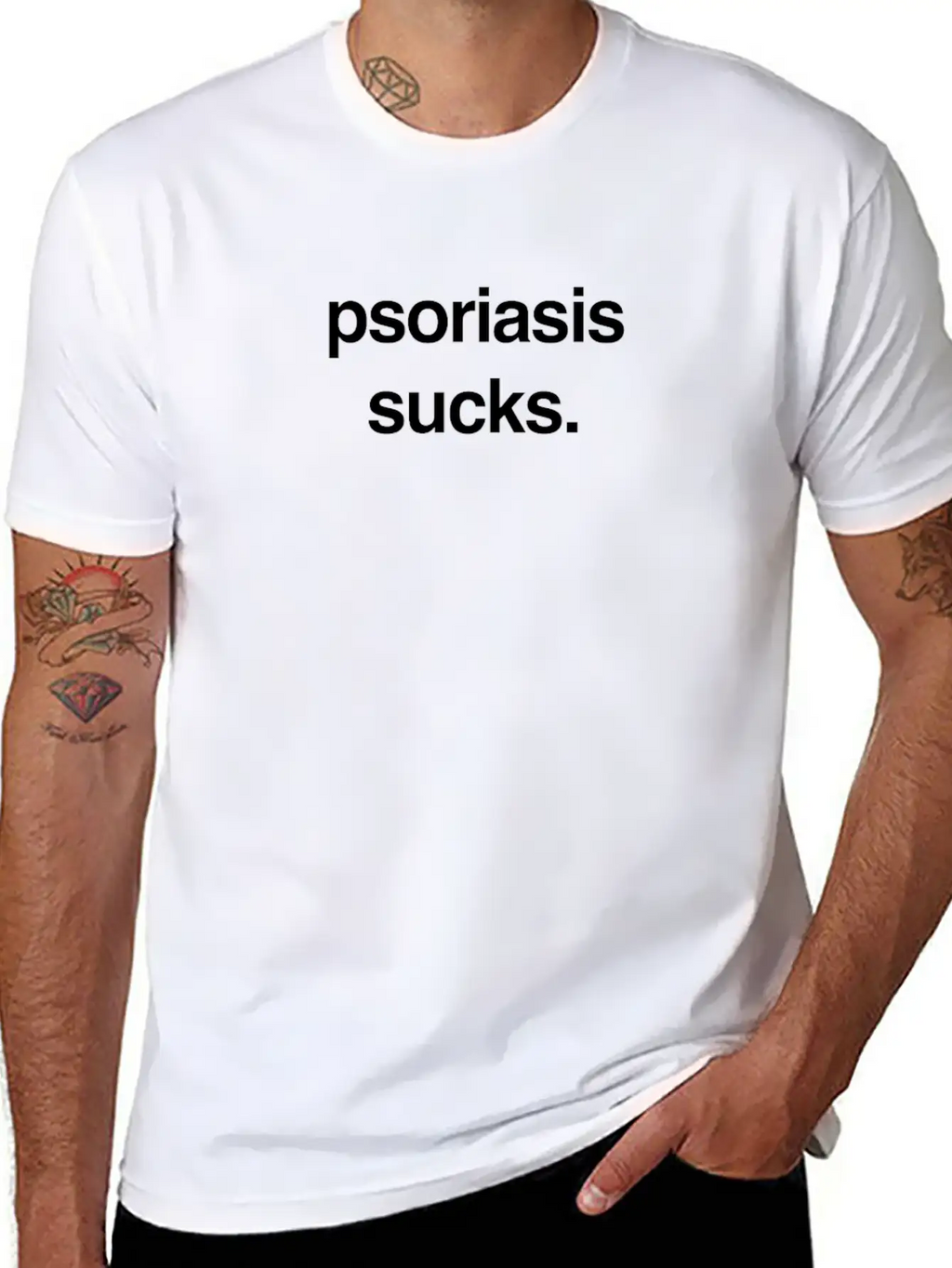 Sucks - Skin Psoriasis Awareness Gift Breathable Soft Cotton T-Shirt – Timeless Casual Look